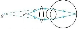 correction-for-hypermetropic-eye (1)